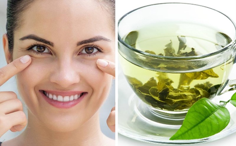 Top 05 lợi ích của trà xanh - Trị mụn & làm đẹp